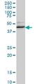 RNA Binding Fox-1 Homolog 2 antibody, ab57154, Abcam, Western Blot image 