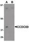 Coiled-Coil Domain Containing 69 antibody, PA5-20935, Invitrogen Antibodies, Western Blot image 