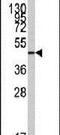 Zinc finger protein ZIC 3 antibody, PA5-12347, Invitrogen Antibodies, Western Blot image 