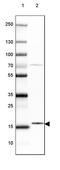 GSK3-beta interaction protein antibody, PA5-60218, Invitrogen Antibodies, Western Blot image 