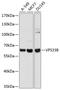 Vacuolar protein sorting-associated protein 33B antibody, GTX65908, GeneTex, Western Blot image 