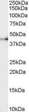 Ciliary Neurotrophic Factor Receptor antibody, PA5-18622, Invitrogen Antibodies, Western Blot image 