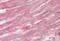 Actin Related Protein 2/3 Complex Subunit 1A antibody, orb12391, Biorbyt, Immunohistochemistry paraffin image 