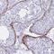 ELN antibody, NBP2-33805, Novus Biologicals, Immunohistochemistry paraffin image 
