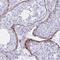 Elastin antibody, NBP2-33805, Novus Biologicals, Immunohistochemistry paraffin image 