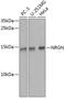 Neurogranin antibody, GTX64685, GeneTex, Western Blot image 