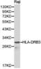 Major Histocompatibility Complex, Class II, DR Beta 3 antibody, PA5-37365, Invitrogen Antibodies, Western Blot image 