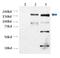 Transient Receptor Potential Cation Channel Subfamily M Member 2 antibody, TA336551, Origene, Western Blot image 