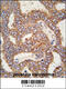 Transient Receptor Potential Cation Channel Subfamily M Member 8 antibody, 63-453, ProSci, Immunohistochemistry paraffin image 