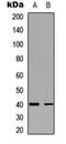 Potassium Two Pore Domain Channel Subfamily K Member 1 antibody, orb256643, Biorbyt, Western Blot image 