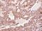 Rho GDP Dissociation Inhibitor Alpha antibody, NBP2-20159, Novus Biologicals, Immunohistochemistry paraffin image 