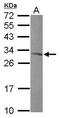 Mitochondrial Ribosomal Protein L10 antibody, GTX118663, GeneTex, Western Blot image 