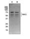 Telomeric Repeat Binding Factor 2 antibody, TA337130, Origene, Western Blot image 