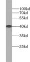 Asialoglycoprotein Receptor 1 antibody, FNab00635, FineTest, Western Blot image 