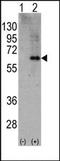 Protein Kinase AMP-Activated Catalytic Subunit Alpha 2 antibody, AP14053PU-N, Origene, Western Blot image 