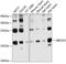 Ubiquitin Conjugating Enzyme E2 G2 antibody, GTX64782, GeneTex, Western Blot image 