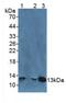 Beta-2-Microglobulin antibody, LS-C300078, Lifespan Biosciences, Western Blot image 