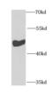 Inositol Polyphosphate-5-Phosphatase K antibody, FNab04331, FineTest, Western Blot image 