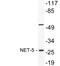 Tetraspanin 9 antibody, LS-B13448, Lifespan Biosciences, Western Blot image 