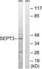 Septin 3 antibody, LS-C120158, Lifespan Biosciences, Western Blot image 