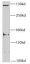 SET Domain Containing 2, Histone Lysine Methyltransferase antibody, FNab07767, FineTest, Western Blot image 