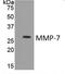 Matrix Metallopeptidase 7 antibody, GTX52475, GeneTex, Western Blot image 