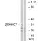 Zinc Finger DHHC-Type Containing 7 antibody, A11785, Boster Biological Technology, Western Blot image 