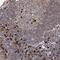 WD Repeat Domain 75 antibody, HPA038199, Atlas Antibodies, Immunohistochemistry paraffin image 