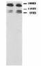 Glutamate Ionotropic Receptor NMDA Type Subunit 2B antibody, LS-C171803, Lifespan Biosciences, Western Blot image 