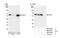 Karyopherin Subunit Alpha 2 antibody, NB100-79807, Novus Biologicals, Western Blot image 