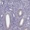 PDZ Binding Kinase antibody, HPA050656, Atlas Antibodies, Immunohistochemistry frozen image 