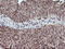 Tryptase Gamma 1 antibody, M14320, Boster Biological Technology, Immunohistochemistry paraffin image 