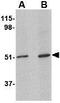 Ceramide Synthase 5 antibody, GTX31365, GeneTex, Western Blot image 