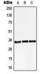 StAR Related Lipid Transfer Domain Containing 10 antibody, MBS820621, MyBioSource, Western Blot image 