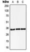 StAR Related Lipid Transfer Domain Containing 10 antibody, MBS820621, MyBioSource, Western Blot image 