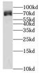 Kelch Like Family Member 10 antibody, FNab04609, FineTest, Western Blot image 