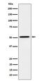 Hepatocyte Nuclear Factor 4 Alpha antibody, M00389-3, Boster Biological Technology, Western Blot image 