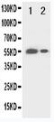 Glucuronidase Beta antibody, PA5-79343, Invitrogen Antibodies, Western Blot image 