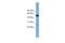 DEP Domain Containing 7 antibody, A14841, Boster Biological Technology, Western Blot image 