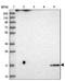 Cerebral dopamine neurotrophic factor antibody, NBP1-88994, Novus Biologicals, Western Blot image 