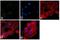 Eukaryotic Translation Initiation Factor 2 Subunit Alpha antibody, GTX25369, GeneTex, Immunocytochemistry image 