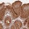 StAR Related Lipid Transfer Domain Containing 7 antibody, NBP2-49433, Novus Biologicals, Immunohistochemistry frozen image 