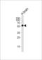 Cyclin Dependent Kinase 14 antibody, LS-C99915, Lifespan Biosciences, Western Blot image 