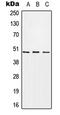 Carbohydrate Sulfotransferase 1 antibody, MBS821665, MyBioSource, Western Blot image 