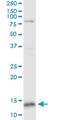 Glutaredoxin 5 antibody, H00051218-M04, Novus Biologicals, Western Blot image 