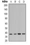 NFKB Inhibitor Alpha antibody, orb339015, Biorbyt, Western Blot image 