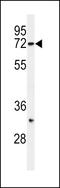 Synoviolin 1 antibody, LS-C165013, Lifespan Biosciences, Western Blot image 