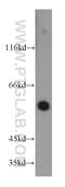 NADPH Oxidase 3 antibody, 20065-1-AP, Proteintech Group, Western Blot image 