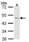 Acid Phosphatase, Prostate antibody, LS-C186342, Lifespan Biosciences, Western Blot image 