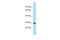 Testis Expressed 35 antibody, PA5-45990, Invitrogen Antibodies, Western Blot image 